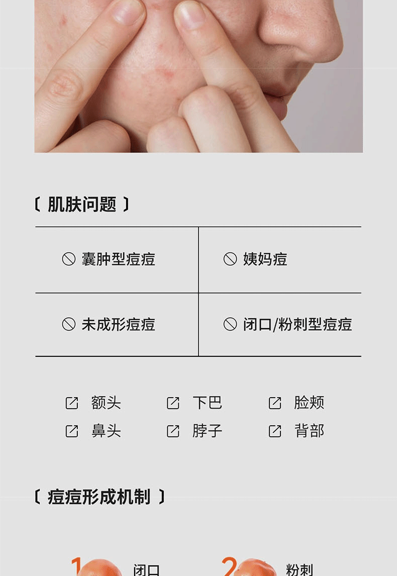 韩伦美羽胶态硫祛痘大灯泡精华液控油去痘闭口粉刺痘印痘坑提亮肤色 