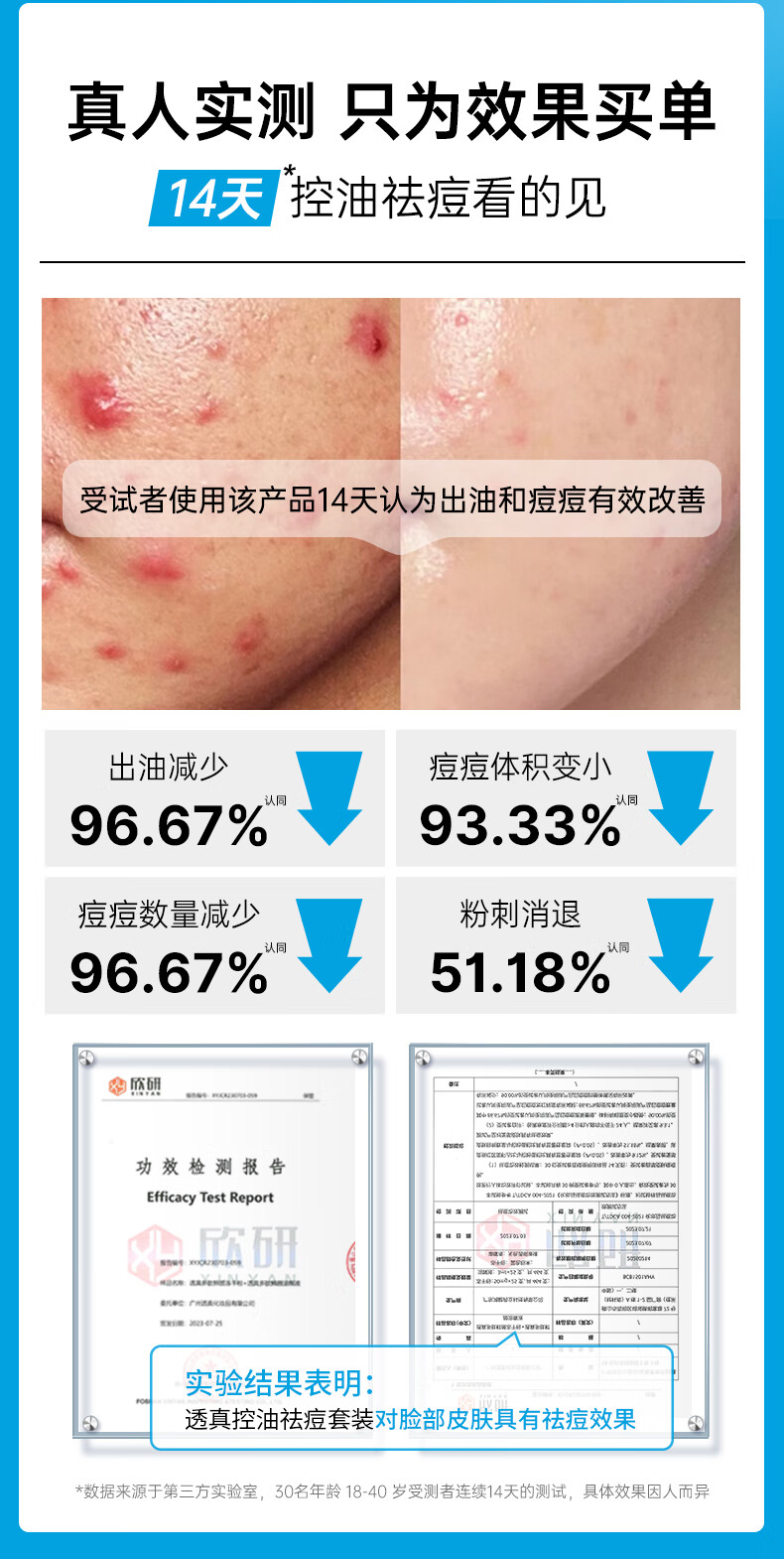 透真清颜水杨酸祛痘修护舒缓凝胶控油淡化痘印痘坑20g