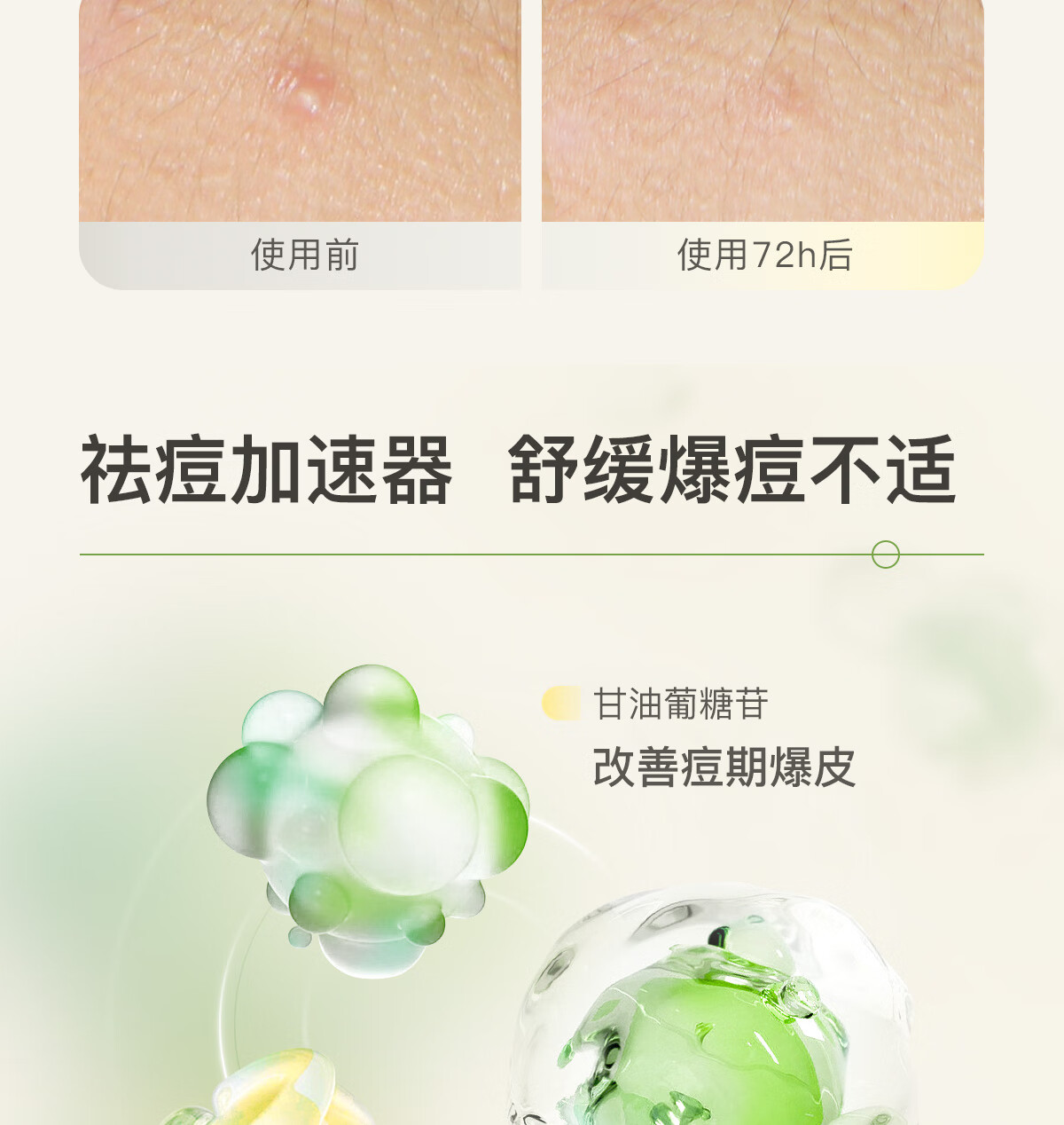 悦芙媞【会员专享】点痘精华3g尝鲜快速瘪痘修护舒缓淡红印控油祛痘精华