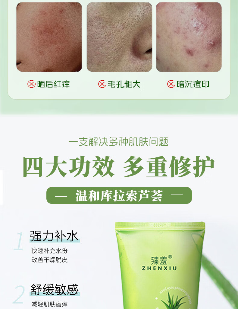 臻羞芦荟胶祛痘淡化痘印舒缓呵护晒后修复肌肤补水保湿男女60g