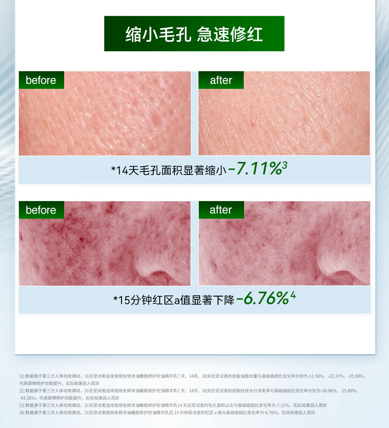 安修泽油橄榄水乳套装敏感肌控油修红急护补水保湿水150ml+乳120ml