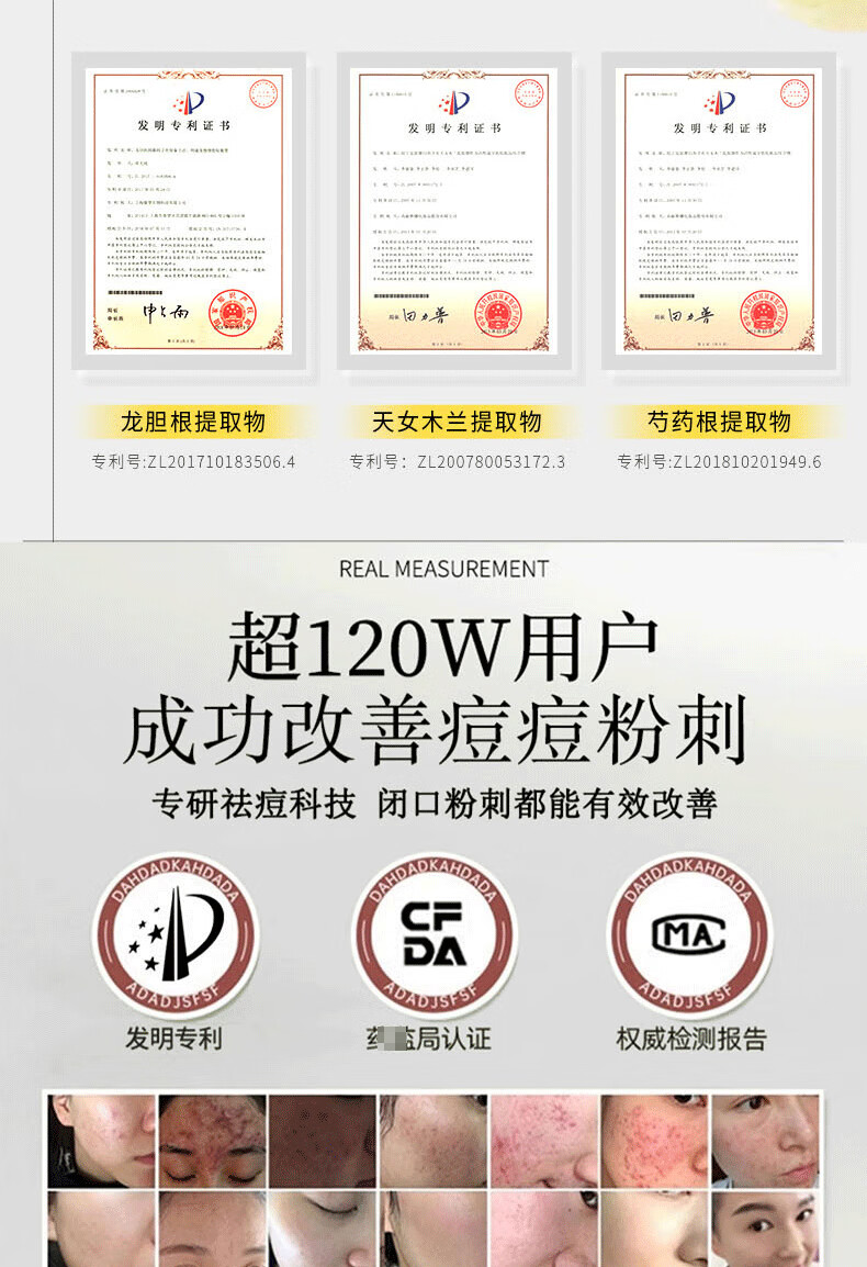 韩伦美羽胶态硫祛痘大灯泡精华液控油去痘闭口粉刺痘印痘坑提亮肤色 
