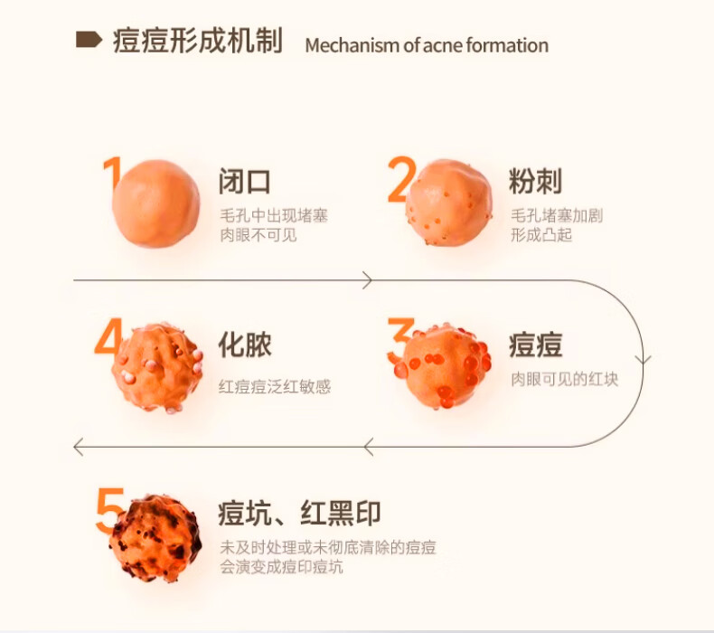 致朵祛痘霜膏修护淡化痘印痘坑去痘痘和痘痘印祛去粉刺青春痘30g/瓶