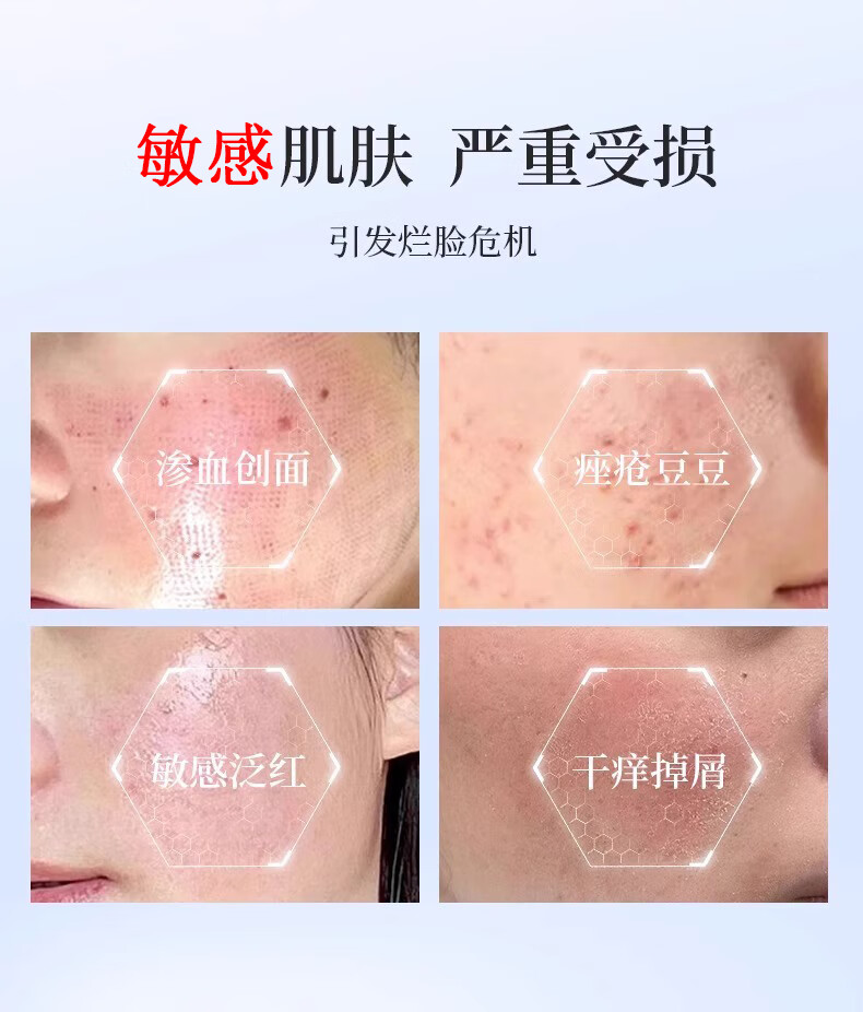 可福佳敏感肌面膜护肤品红血丝屏障受损修护脸部泛红舒缓补水 25ml*10片