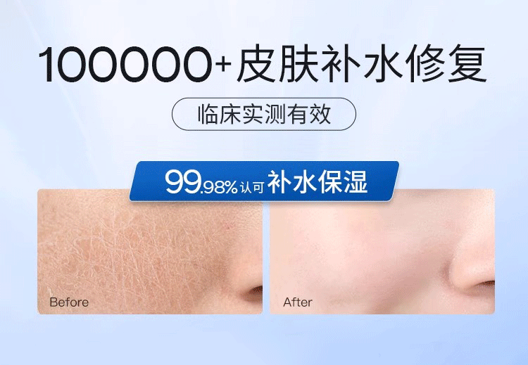 可福佳敏感肌面膜护肤品红血丝屏障受损修护脸部泛红舒缓补水 25ml*10片