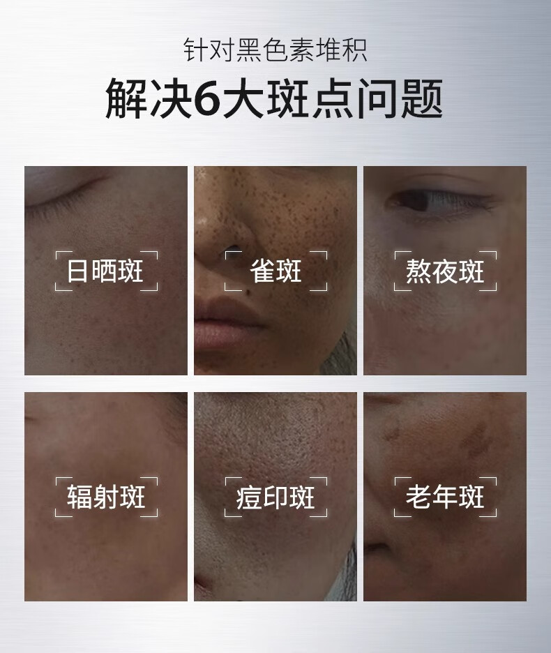 ning新加坡进口美白淡斑霜祛斑淡化提亮肤色改善暗沉淡化黑色素黄褐斑