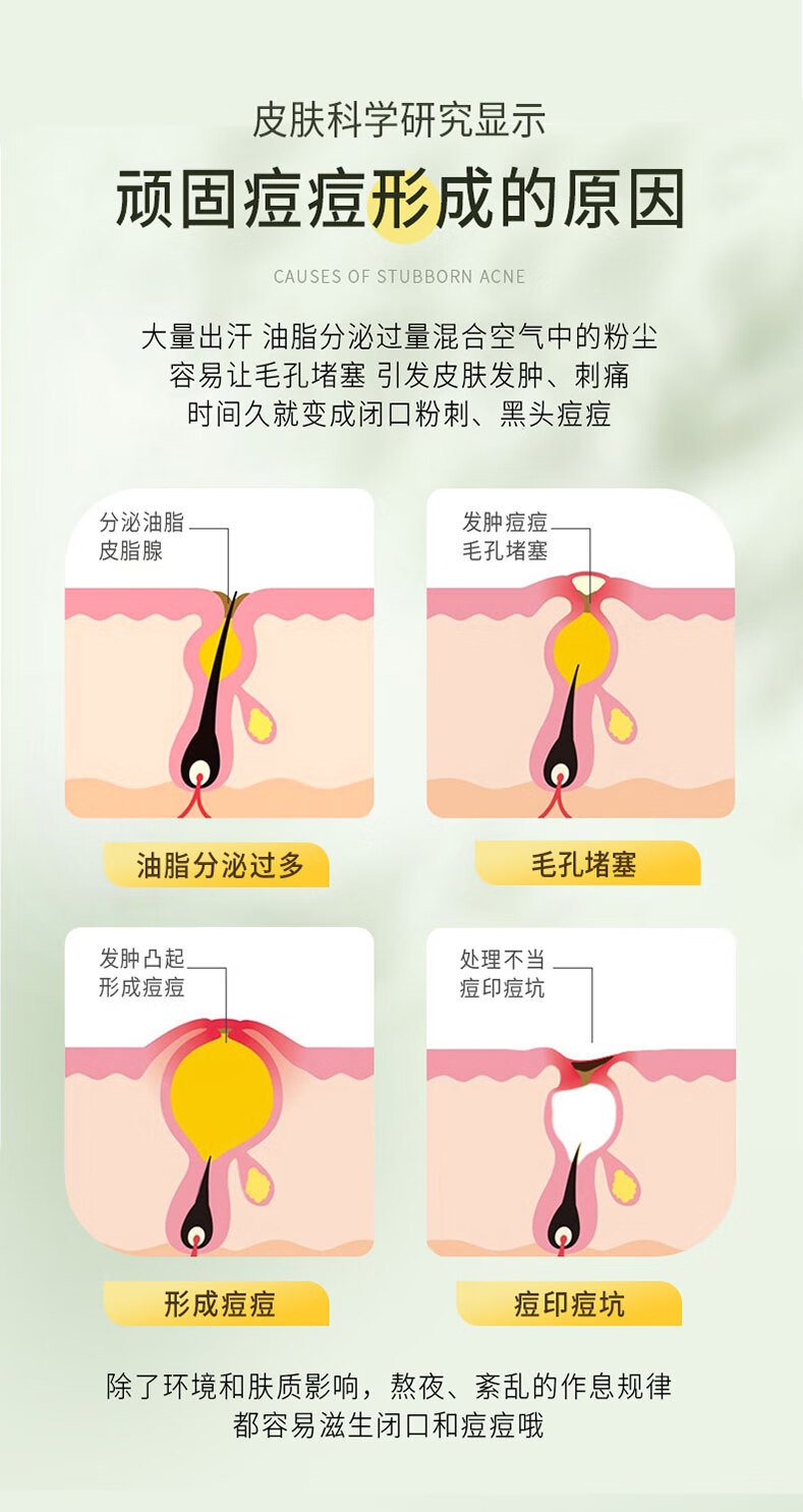 臻羞水杨酸祛痘膏痘印淡化痘坑去痘痘和痘印青春痘学生