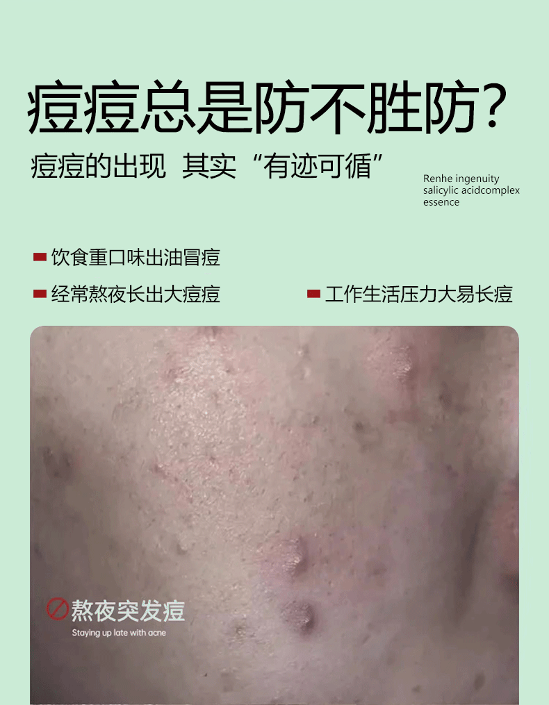 仕月油橄榄祛痘精华液面部舒缓补水改善敏感肌泛红面部精华30ml