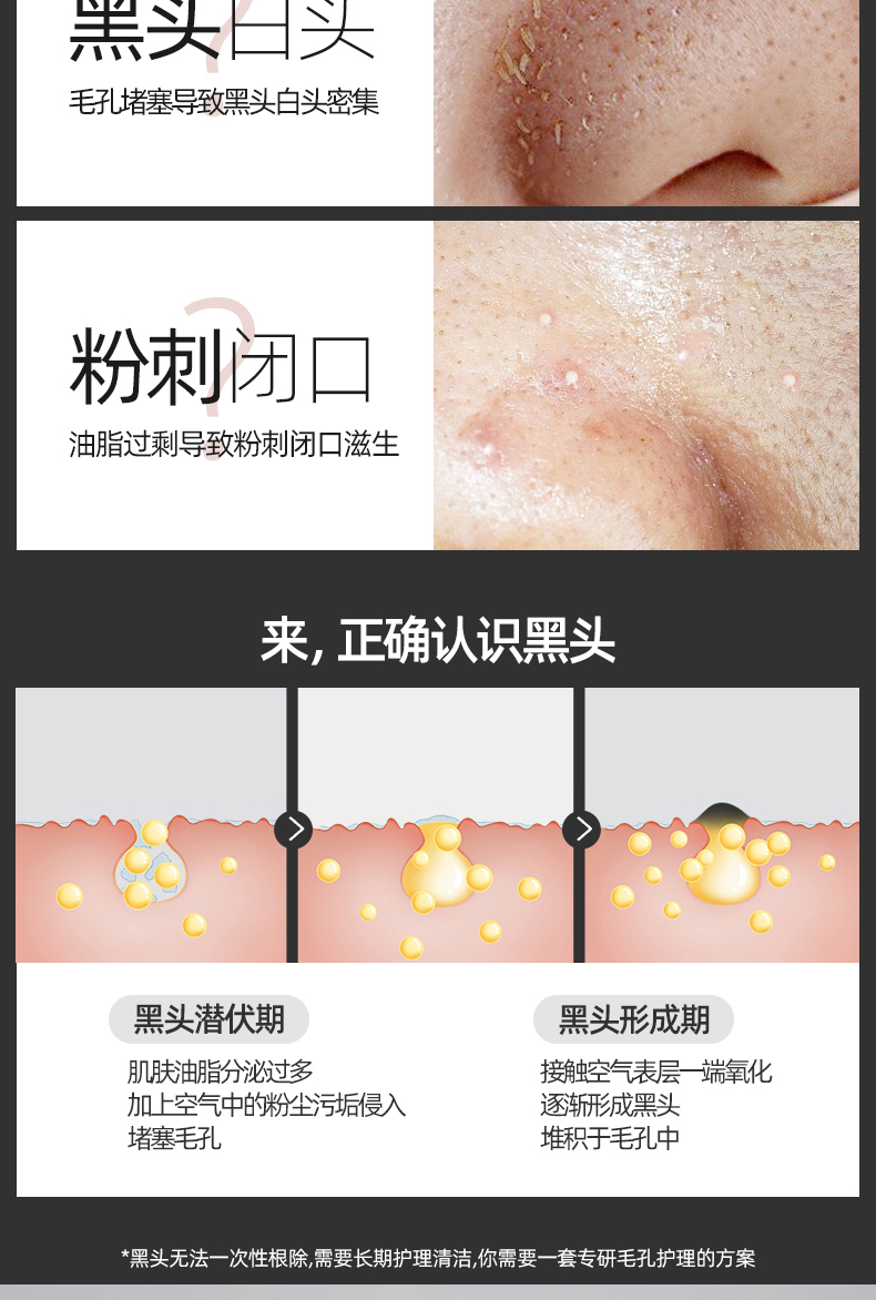 清洁草莓鼻！撕拉式去黑头鼻贴膜三部曲套装 祛粉刺黑头导出液清洁收缩毛孔面膜泥男女学生 fUT