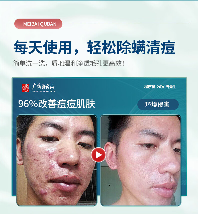 白云山祛痘面膜去淡化痘印痘坑痘痘水杨酸收缩毛孔去黑头粉刺闭口补水保湿男女士清洁面膜25ml*10片