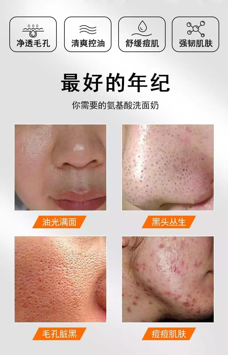 广药白云山  控油洗面奶男女痘痘螨虫青少年深层清洁黑头角质收缩毛孔氨基酸洁面乳100g