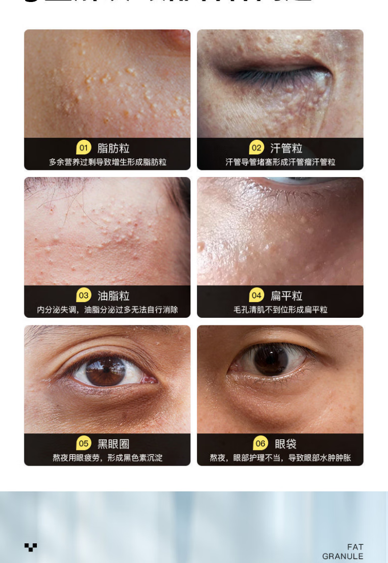 广药白云山眼霜淡化细纹脂肪粒汗管粒眼袋黑眼圈净痘颗粒清眼部精华液油脂粒男女通用30ml