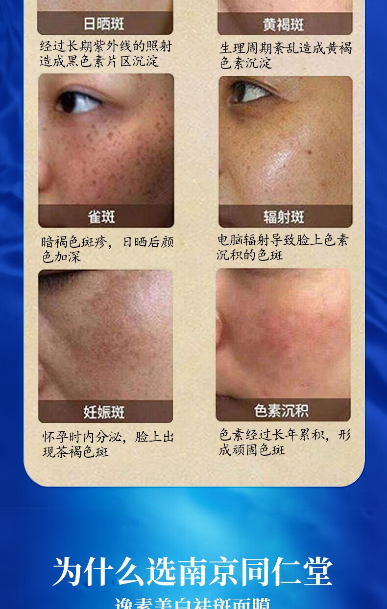 同仁堂祛斑美白面膜补水去斑黄褐斑老人斑雀斑晒斑保湿提亮肤色男女通用20片/盒