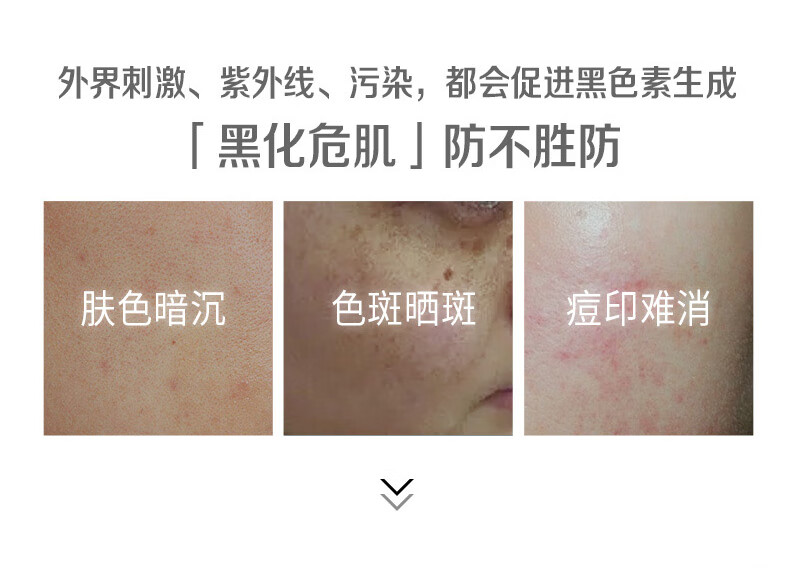 樊文花（fawa）4号焕白淡斑霜377美白淡斑提亮肤色烟酰胺祛斑淡痘印面霜女 30g