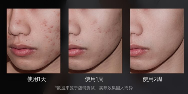 仁和匠心植物复合洗面奶氨基酸洗面奶男女除螨控油祛痘温和去角质黑头深层清洁收缩毛洁面乳男士洗面奶150g