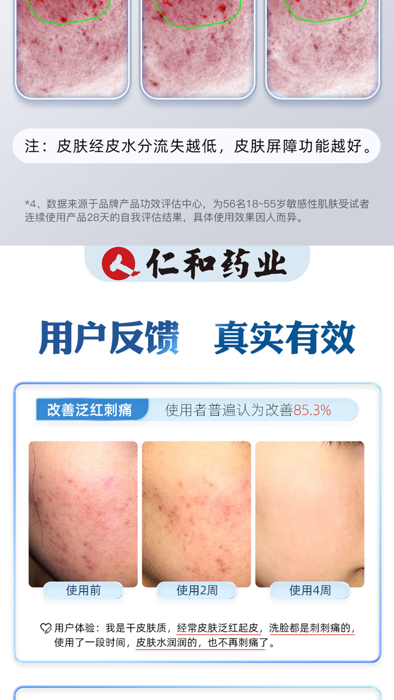 美颜笔记仁和匠心红血丝皮肤屏障修护精华液改善面部泛红补水男女30ml