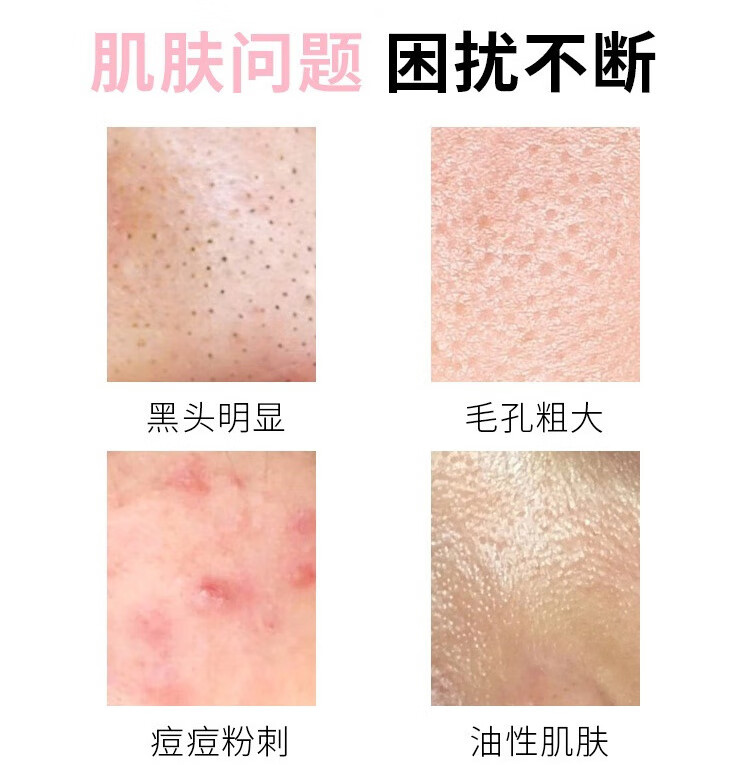 佰萃莱 壬二酸15%凝胶和水杨酸细致毛孔霜痘印黑头粉刺去面霜套装30g*2