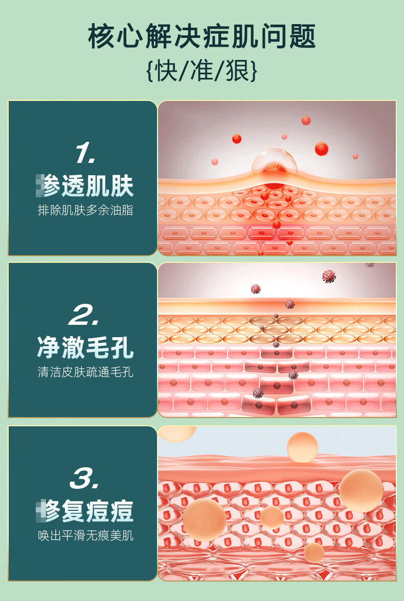 仕月油橄榄祛痘精华液面部舒缓补水改善敏感肌泛红面部精华30ml