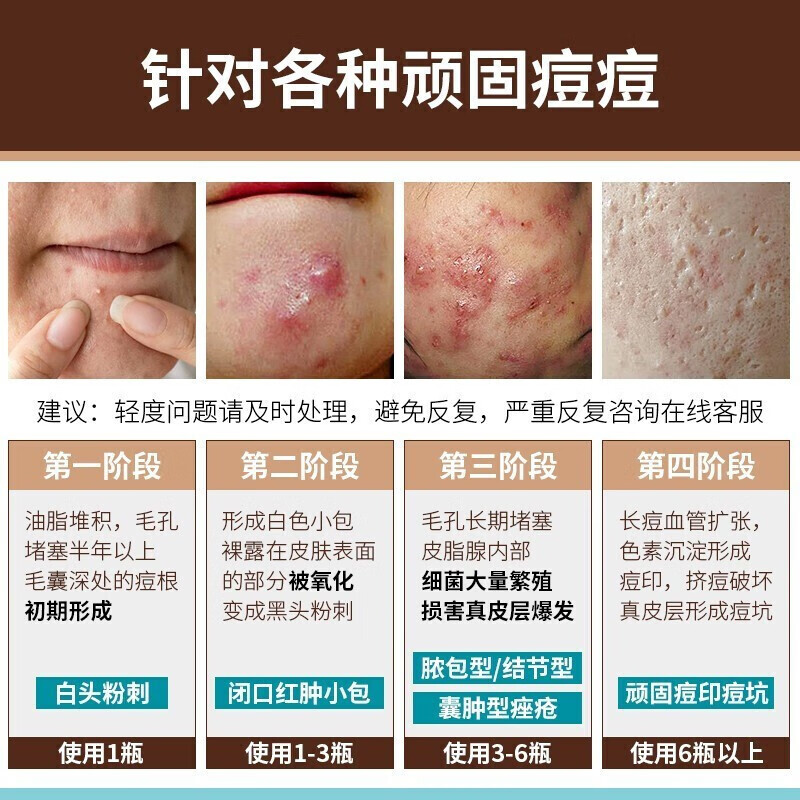云南本草祛痘膏痘痘肌修护祛痘男女青春红肿痘闭口粉刺芦荟胶22g