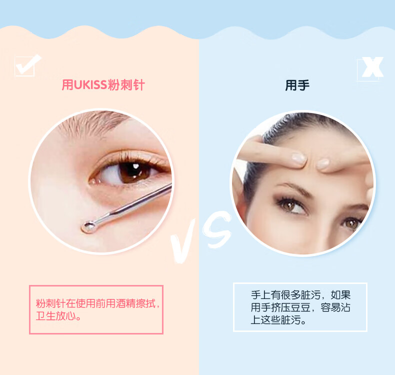 悠珂思（ukiss）双头粉刺针（黑头暗疮针 痘痘美容针  挑痘挤痘粉刺夹细胞夹）