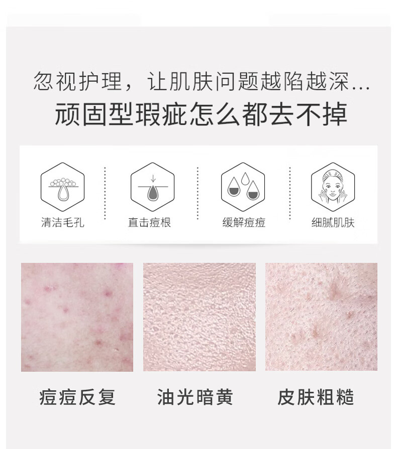 THE ORDINARY30%果酸+2%水杨酸面膜精华液去角质清理闭口粉刺30ml*2纯净护肤