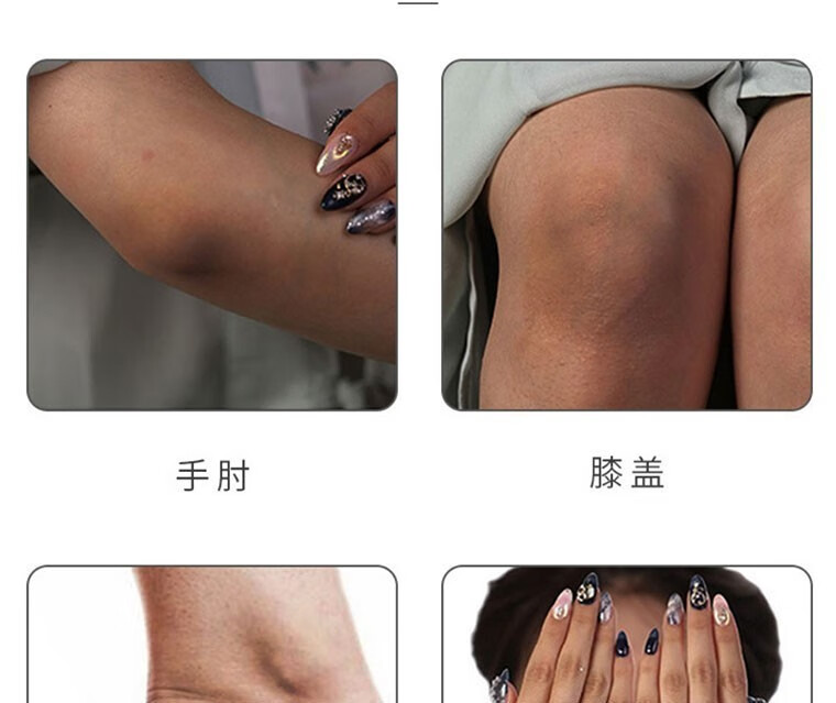 NHFOUYOU【不黑不买】美白全身关节膝盖手指手肘脖子美白祛斑霜淡化色素 1盒【建议按疗程】