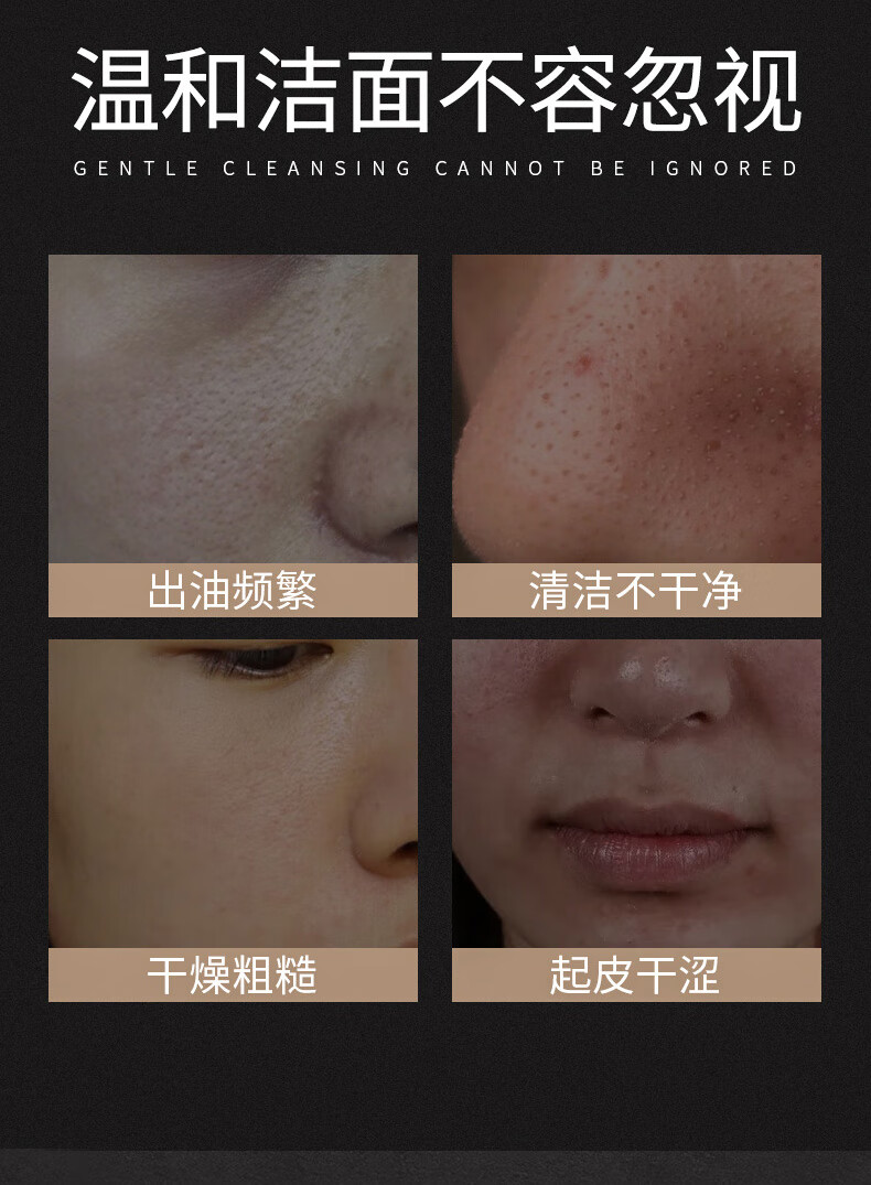 AOPY 氨基酸净颜洗面奶200g 去黑头控油去角质卸妆  男女洁面保湿