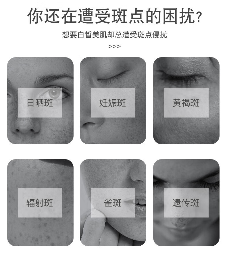 BAILUHUI南京同仁堂美白祛斑霜去斑淡斑淡化黑色素老年斑20g
