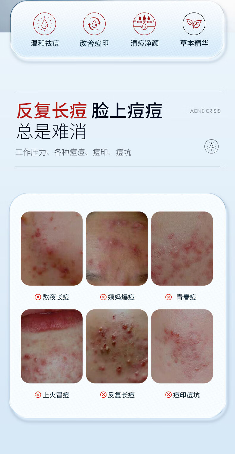 国药精养祛痘膏去痘疤淡化痘印痘坑修复痘肌亮肤青春痘40g