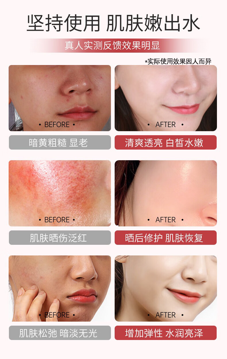 Binee韩国玫瑰软膜粉面膜泥膜补水保湿滋养深层清洁涂抹式DIY面膜500g