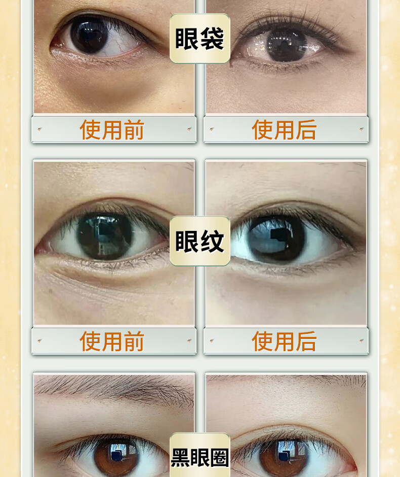 国药精养 蛇毒眼膜贴眼贴眼袋消男士黑眼圈细纹补水保湿紧致抗皱眼贴膜男女通用1.4g*60片