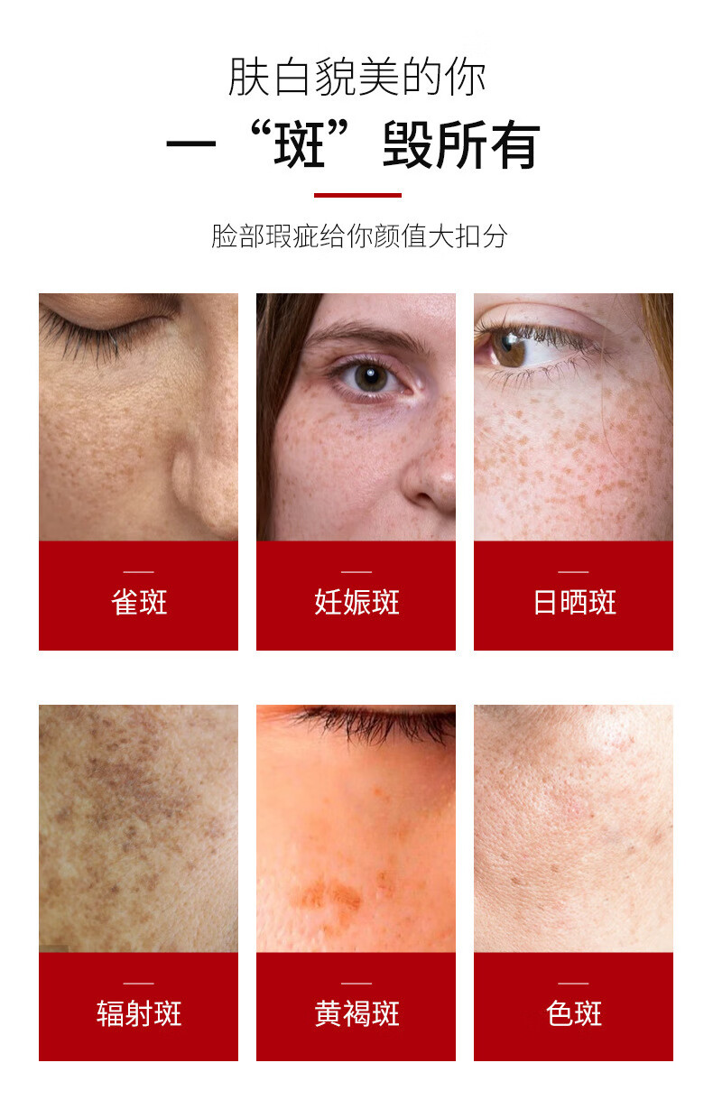 beauty notes南京同仁堂美白祛斑霜淡斑去斑淡化黑色素沉淀脸部老年斑20g