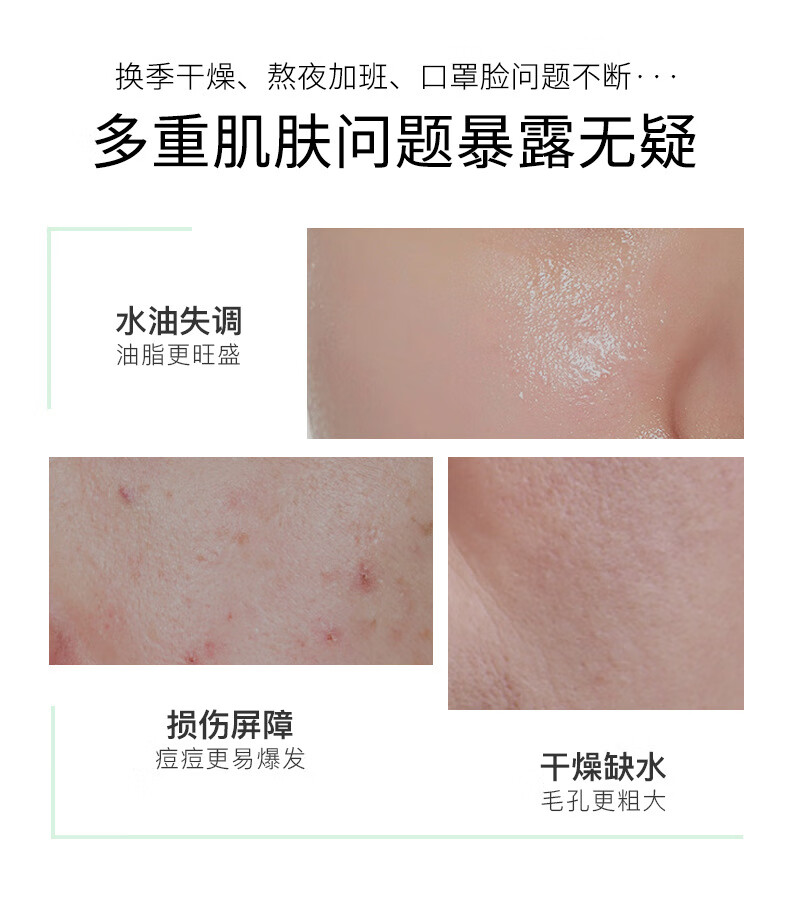 倾龄微酸积雪草小气泡面膜mdb自发泡收缩毛孔清洁官方旗舰店 3支装