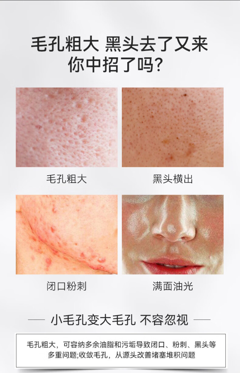 仁和匠心净透毛孔收缩精华液毛孔粗大修复细致精华液收敛缩小男女100ml
