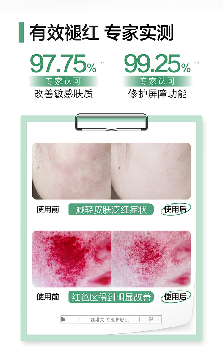 丝塔芙舒缓修护面霜10ml 补水保湿敏感肌护肤品