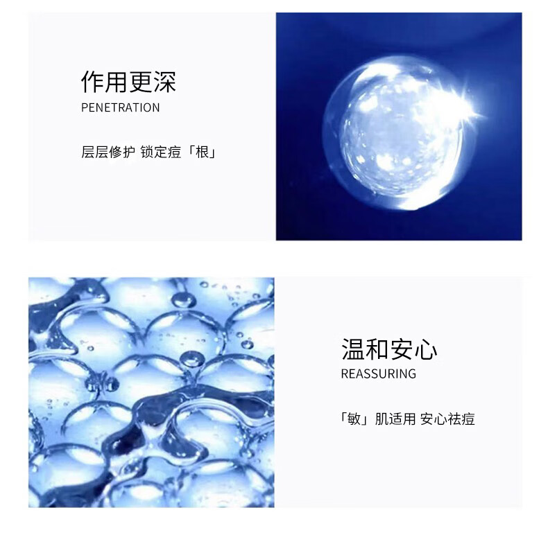 beauty notes祛痘膏 祛痘净肤膏亮肤青春痘控油学生男女士淡化青春痘印修护30g