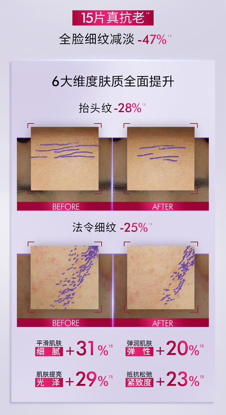欧莱雅安瓶面膜 淡化细纹 玻尿酸补水保湿 护肤品 礼物送女友送闺蜜 【明星面膜】安瓶面膜15片