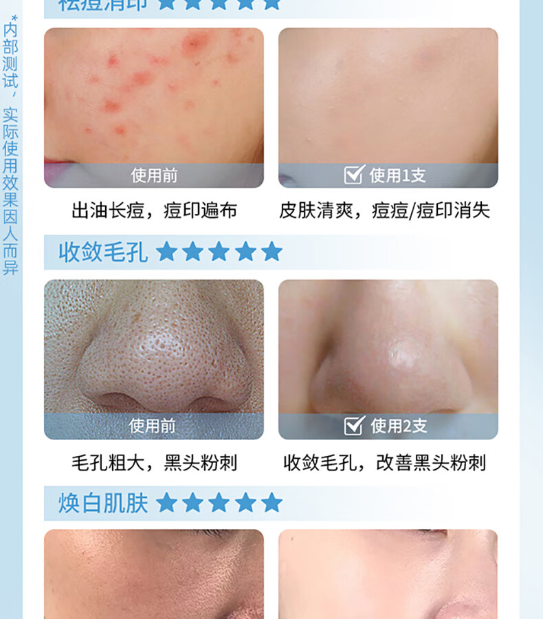 MAIGOOLE氨基酸刷头洗面奶祛净痘控油洁面乳清洁毛孔黑头男女好用120ml