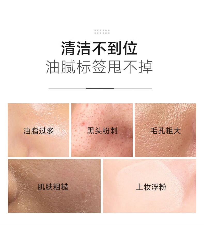 STVKG清洁面膜泥膜去深层清洁黑白头收缩毛孔涂抹男女100g