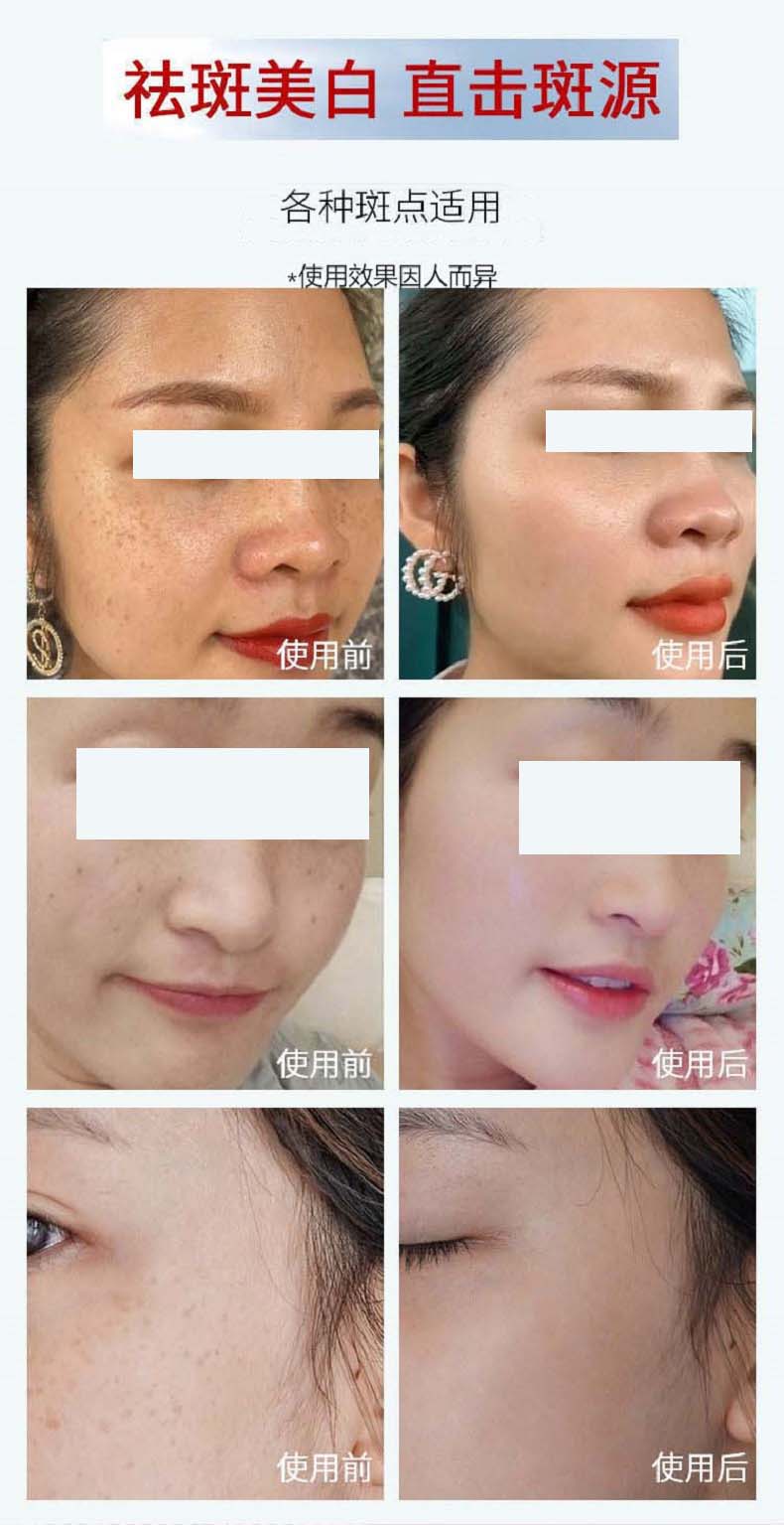 白云山美白祛斑精华液祛斑产品男女烟酰胺去黄淡化去斑溶斑油100ml