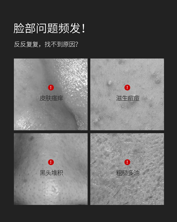 wxe除螨洗面奶200ml 男士控油抗痘洗面奶男 去黑头死皮去角质慕斯洗脸 氨基酸补水保湿收缩毛孔洁面乳