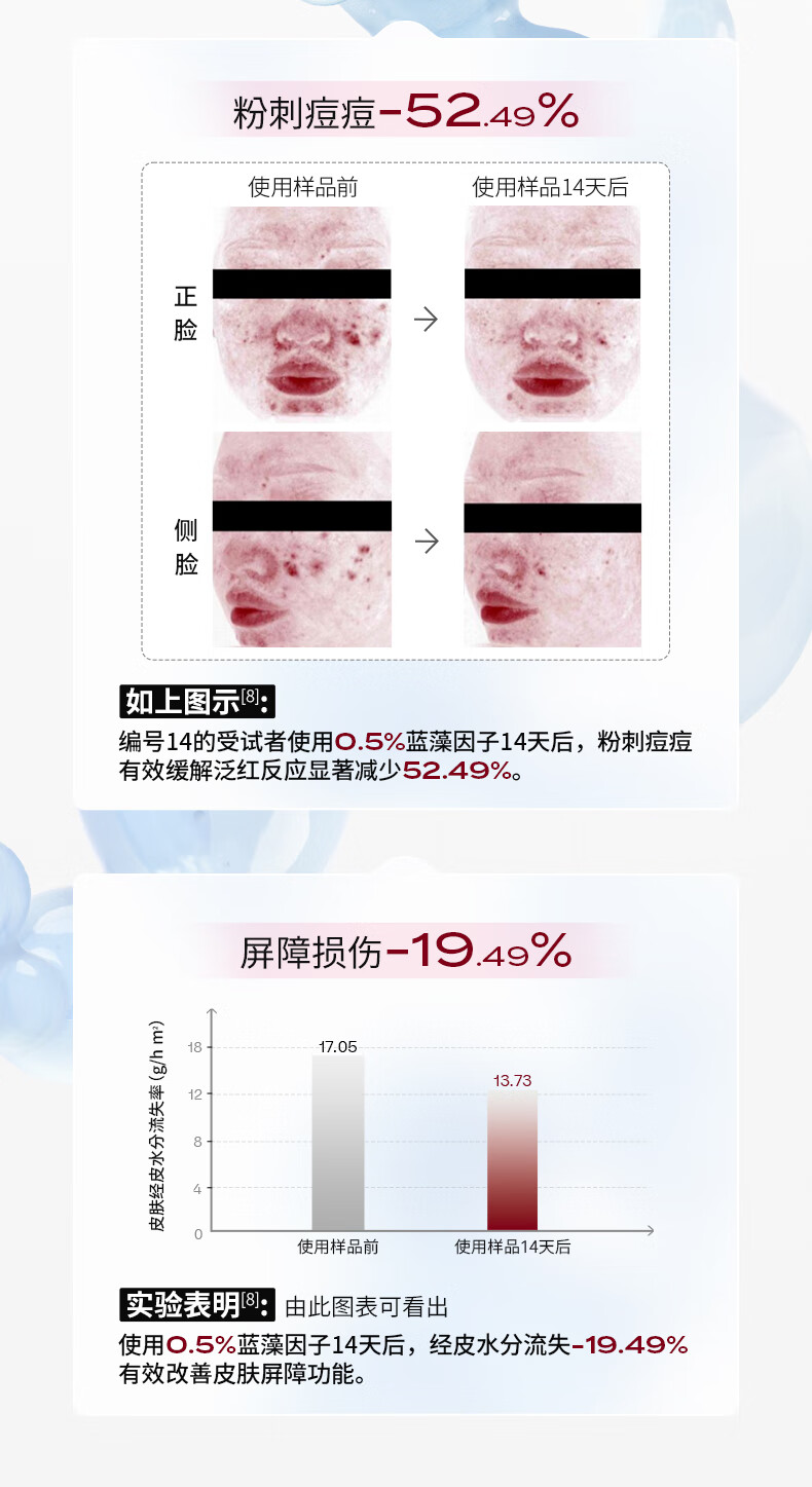 沫润（MORUN）维生素原B5精华舒润保湿小粉墩修护精华液补水玻尿酸国货护肤品 b5精华 30ml/瓶