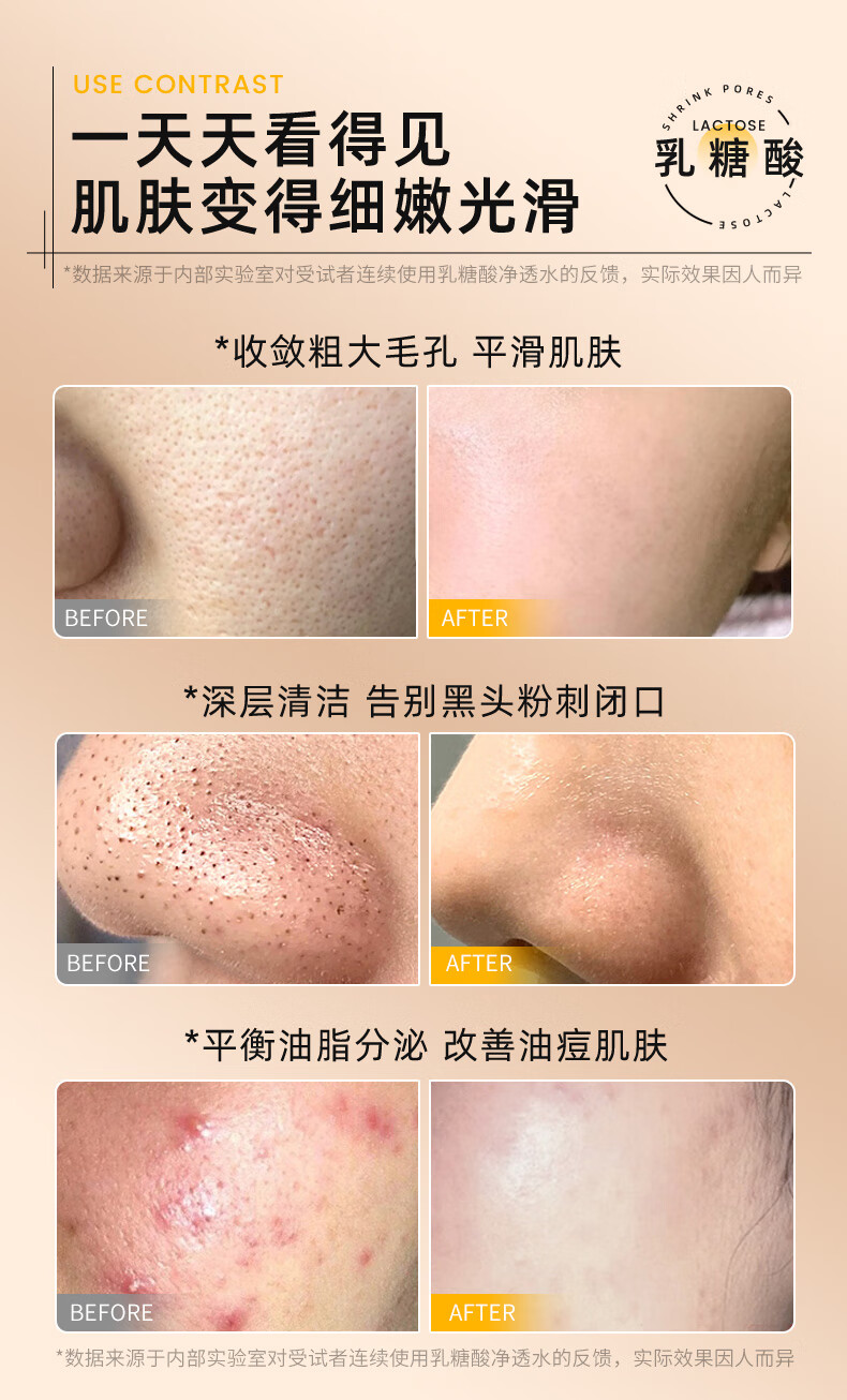 韩舜妆 （HORNCOS）乳糖酸毛孔净透水爽肤水补水保湿提亮面部湿敷精华原液男女