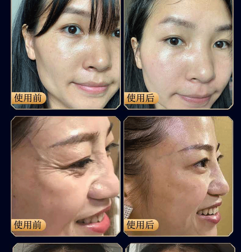广药白云山 类蛇毒眼霜眼袋黑眼圈淡化细纹脂肪粒鱼尾纹提拉紧致眼纹男士女30g