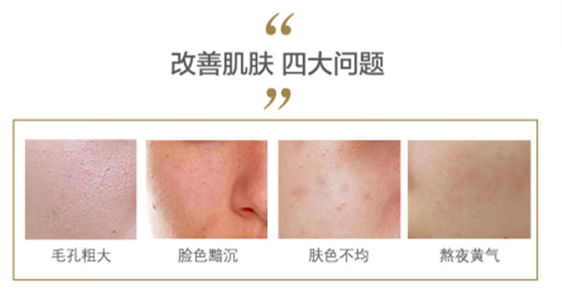 THE ORDINARY烟酰胺+果酸精华套装30ml*2瓶去角质提亮肤色 纯净护肤