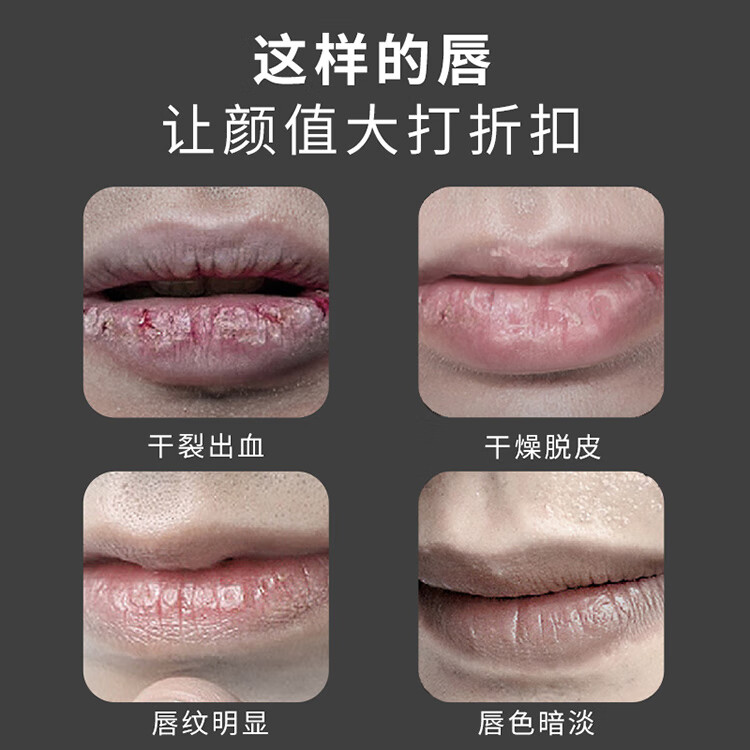 sakose凡士林男士润唇膏套盒2支装共5.6g 养护防干裂脱皮起皮秋冬季舒缓补水去死皮软化角质淡化唇纹男士专用