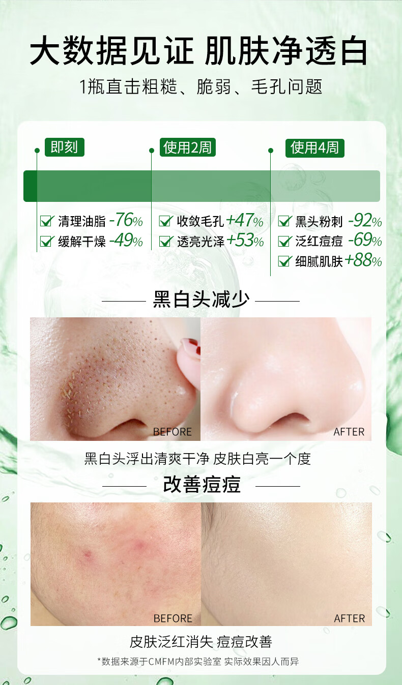 CMFM 微酸积雪草小气泡面膜去黑头收缩毛孔自发泡收缩毛孔控油去嘿头面膜深层清洁补水泥膜100ml