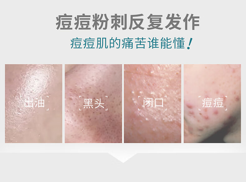 雅漾（Avene）控油抗痘精华露30ml*2油敏肌祛痘细致毛孔平衡水油清痘女神节礼物