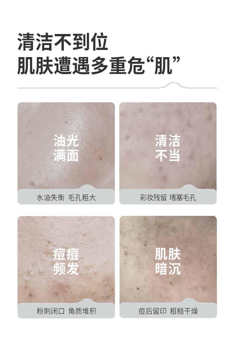 羽素小黄膜涂抹面膜男女清洁泥膜控油祛痘去黑头闭口粉刺清洁毛孔