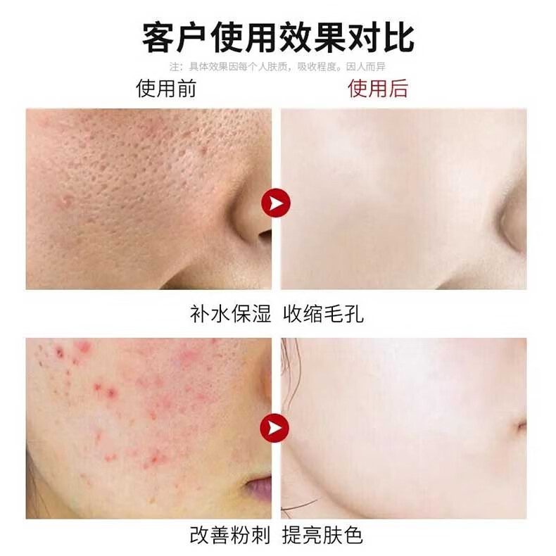 人仁和匠心收缩毛孔爽肤水金盏花精华水保湿补水抗痘毛孔粗大黑头调节水油平衡男女通用